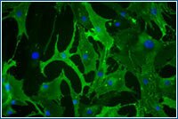 Micrograph of adult stem cells derived from fat tissue.