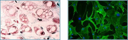 Micrographs of adipose (fat) tissue and adult stem cells.